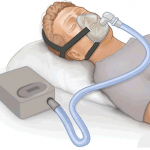 CPAP machine